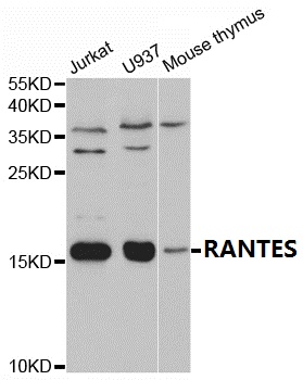 a00617 ccl5 primary antiboties wb testing 1