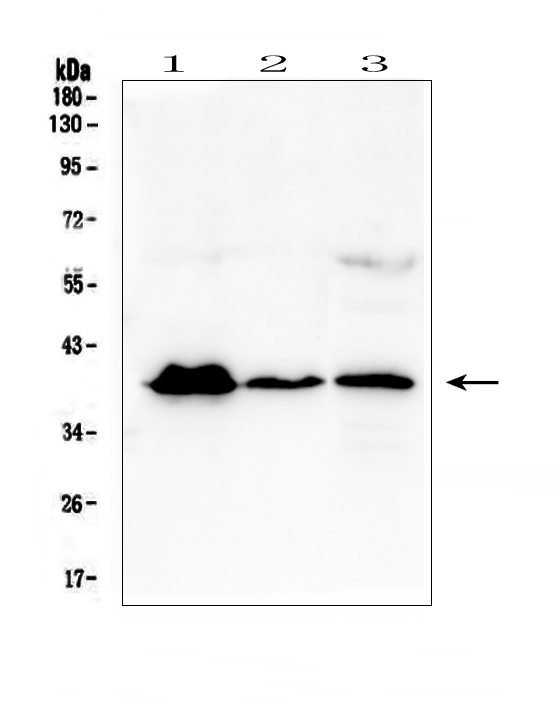 Western blot analysis of MR1 using anti-MR1 antibody (A00618-1). Electrophoresis was performed on a 5-20% SDS-PAGE gel at 70V (Stacking gel) / 90V (Resolving gel) for 2-3 hours. The sample well of each lane was loaded with 50ug of sample under reducing conditions. Lane 1: human T-47D whole cell lysates, Lane 2: human U-937 whole cell lysates, Lane 3: human A431 whole cell lysates. After Electrophoresis, proteins were transferred to a Nitrocellulose membrane at 150mA for 50-90 minutes. Blocked the membrane with 5% Non-fat Milk/ TBS for 1.5 hour at RT. The membrane was incubated with rabbit anti-MR1 antigen affinity purified polyclonal antibody (Catalog # A00618-1) at 0.5 μg/mL overnight at 4°C, then washed with TBS-0.1%Tween 3 times with 5 minutes each and probed with a goat anti-rabbit IgG-HRP secondary antibody at a dilution of 1:10000 for 1.5 hour at RT. The signal is developed using an Enhanced Chemiluminescent detection (ECL) kit (Catalog # EK1002) with Tanon 5200 system. A specific band was detected for MR1 at approximately 40KD. The expected band size for MR1 is at 43KD.