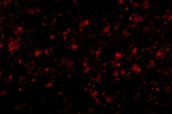 Immunofluorescence of MC4R in Human Brain cells with MC4R antibody at 20 μg/mL