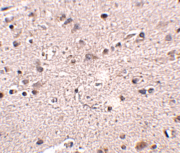 Immunohistochemistry of MC4R in human brain tissue with MC4R antibody at 2
