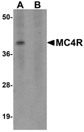 Western blot analysis of MC4R in rat brain tissue lysate with MC4R antibody at 1 μg/mL in (A) the absence and (B) the presence of blocking peptide
