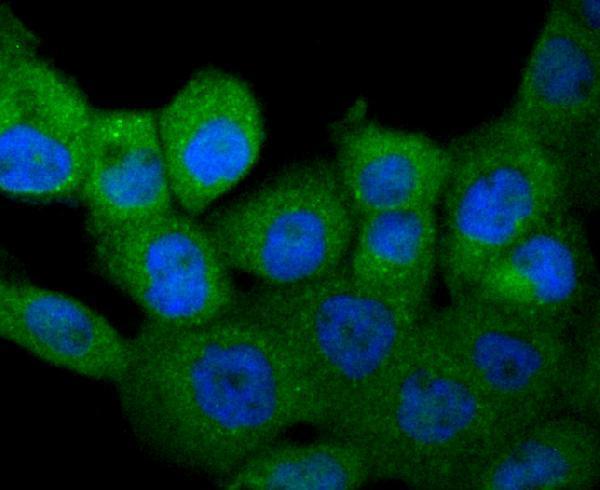 a00620 1 csf1 primary antiboties icc testing 1
