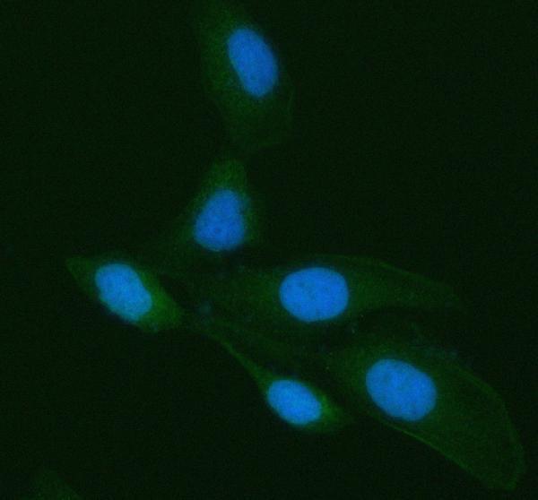 a00621 1 lgals3 primary antibodies if testing 2