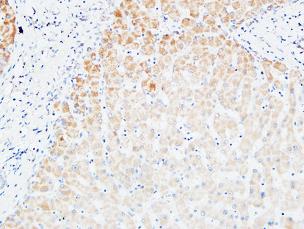 a00623 vegfc primary antibodies ihc testing 1