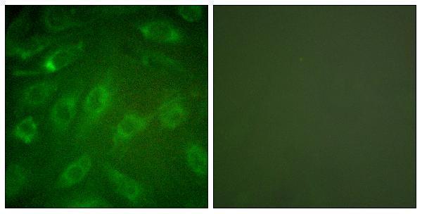 a00624 1 col1a2 primary antibodies if testing 1