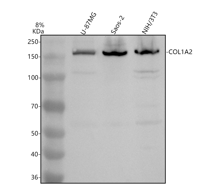 Western blot analysis of Collagen Type I/COL1A2 using anti-Collagen Type I/COL1A2 antibody (A00624-3)