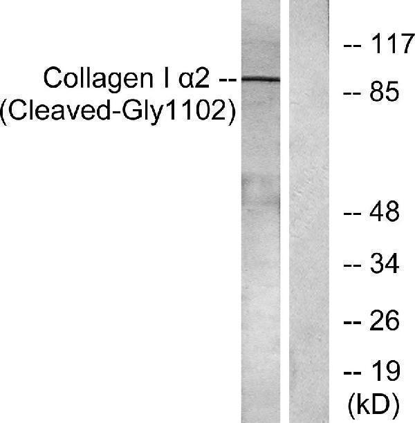 Western blot analysis of lysates from Jurkat cells, treated with etoposide 25uM 24h, using Collagen I alpha2 (Cleaved-Gly1102) Antibody