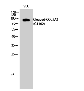 Western Blot analysis of VEC cells using Cleaved-COL1A2 (G1102) Polyclonal Antibody diluted at 1:1000