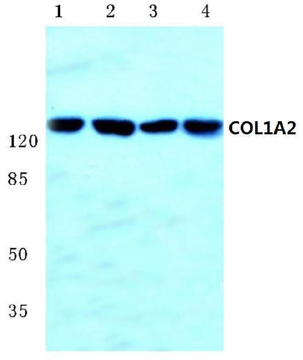 Western blot (WB) analysis of COL1A2 (S3) polyclonal antibody at 1:500 dilution
Lane1:Hela cell lysate
Lane2:Mouse liver tissue lysate
Lane3:Mouse lung tissue lysate
Lane4:Rat liver tissue lysate