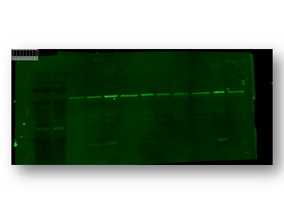 a00625 trpc6 primary antibodies wb testing 2