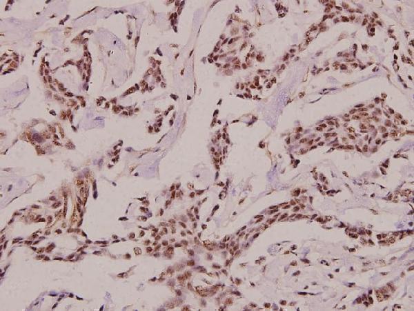 a00629 1 crh primary antiboties ihc testing 2