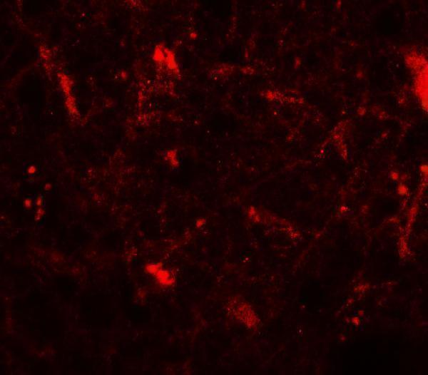 Immunofluorescence of CRH in human brain tissue with CRH antibody at 20 μg/mL