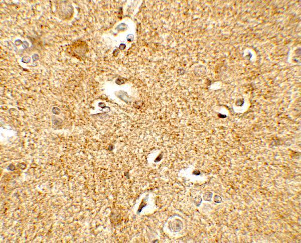 Immunohistochemistry of CRH in human brain tissue with CRH antibody at 5 μg/mL