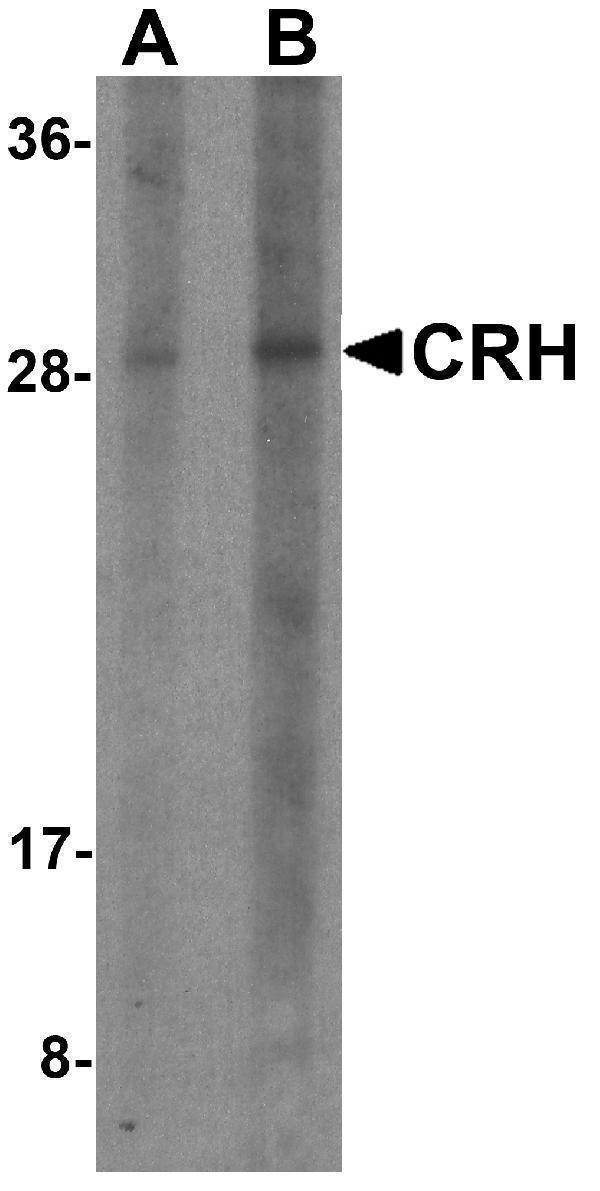 Western blot analysis of CRH in human placenta tissue lysate with CRH antibody at (A) 1 and (B) 2 μg/ml