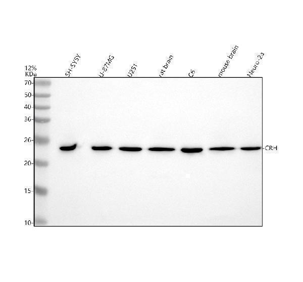  Western blot analysis of CRF/CRH using anti-CRF/CRH antibody (A00629-4)