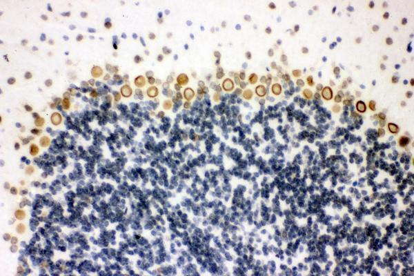  IHC analysis of Sumo 1/SUMO1 using anti-Sumo 1/SUMO1 antibody (A00631-1)
