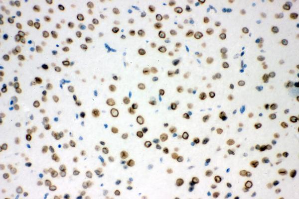 IHC analysis of Sumo 1/SUMO1 using anti-Sumo 1/SUMO1 antibody (A00631-1)