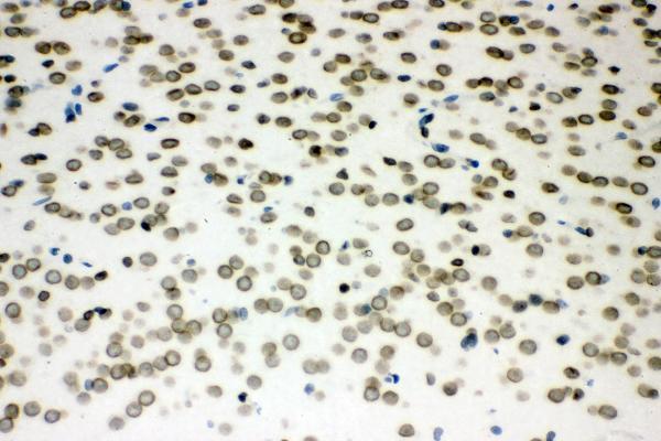  IHC analysis of Sumo 1/SUMO1 using anti-Sumo 1/SUMO1 antibody (A00631-1)