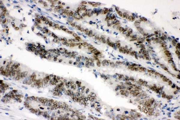 a00631 1 sumo1 primary antibodies ihc testing 4