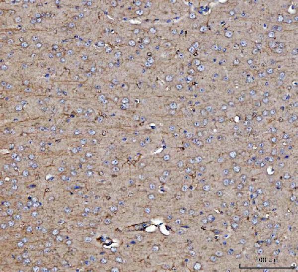  IHC analysis of Dkk1 using anti-Dkk1 antibody (A00632-3)