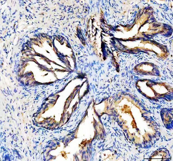 a00633 1 ltf primary antibodies ihc testing 1