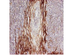 Rabbit anti-Osteopontin was used at a 1:100-1:300 dilution to detect osteopontin by immunohistochemistry