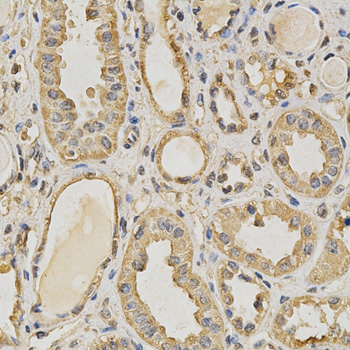 a00635 2 prmt5 primary antiboties ihc testing 2