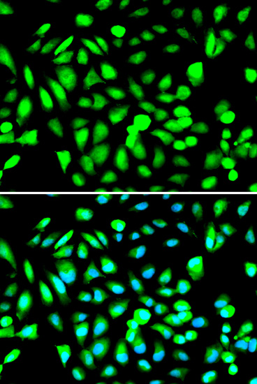 a00635 2 prmt5 primary antiboties ihc testing 3