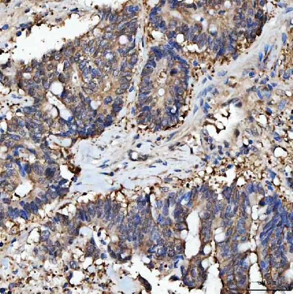  IHC analysis of PRMT5 using anti-PRMT5 antibody (A00635-3)