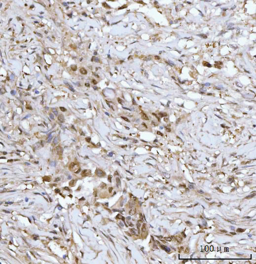  IHC analysis of PRMT5 using anti-PRMT5 antibody (A00635-3)