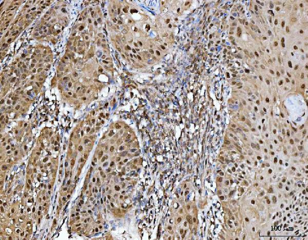 a00635 3 prmt5 primary antibodies ihc testing 4