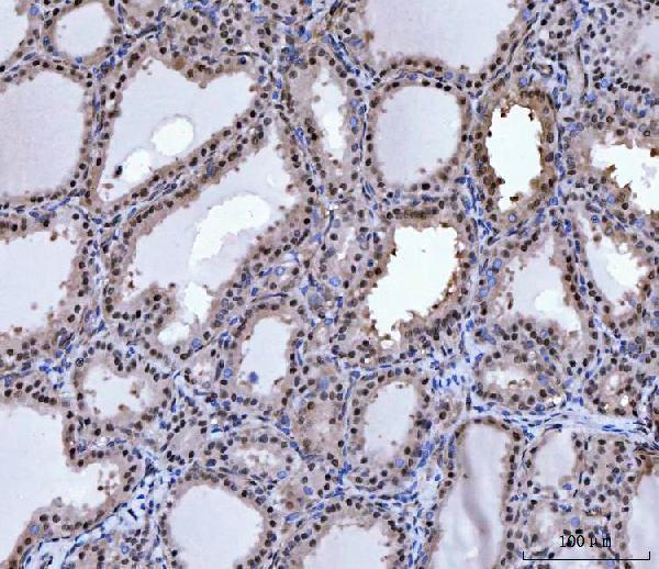 a00635 3 prmt5 primary antibodies ihc testing 5