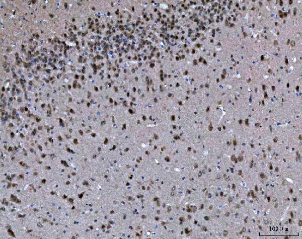 a00635 3 prmt5 primary antibodies ihc testing 6