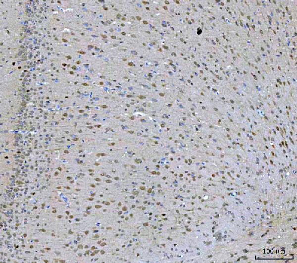 a00635 3 prmt5 primary antibodies ihc testing 7