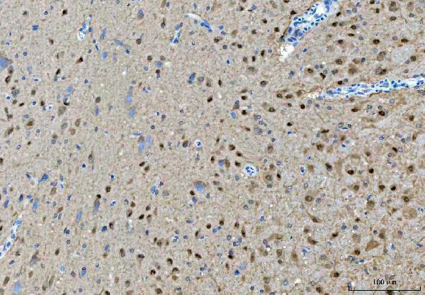 a00635 3 prmt5 primary antibodies ihc testing 8