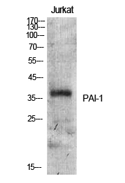 Western blotting validation for Anti-PAI-1 SERPINE1 Antibody A00637
Western Blot (WB) analysis of specific cells using PAI-1 polyclonal antibody