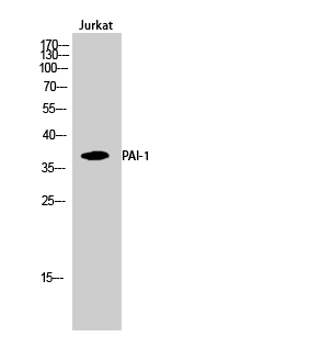 Western blotting validation for Anti-PAI-1 SERPINE1 Antibody A00637
Western Blot (WB) analysis of Jurkat cells using PAI-1 polyclonal antibody