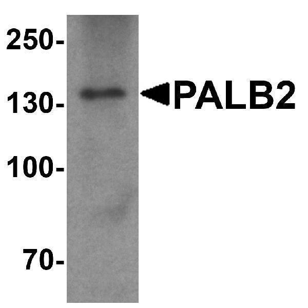 Western blot analysis of PALB2 in SK-N-SH cell lysate with PALB2 antibody at 1 μg/mL