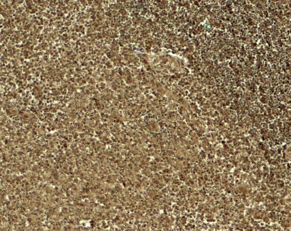 Immunohistochemistry of JAG1 in human spleen tissue with JAG1 antibody at 5 μg/ml