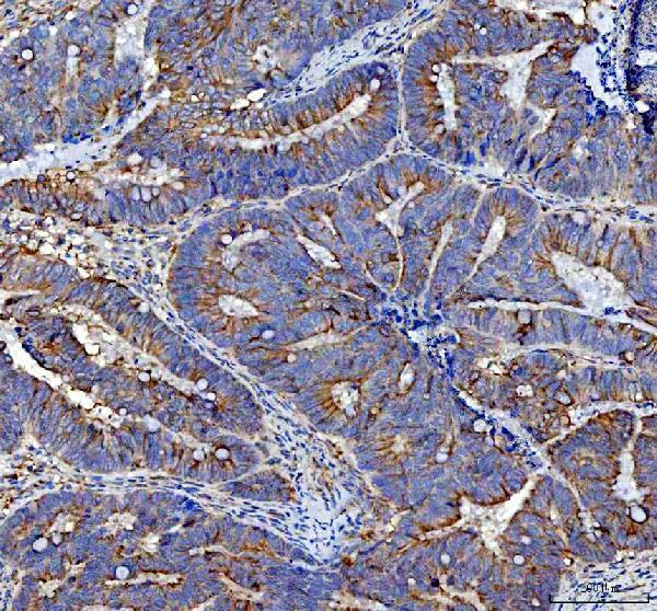 a00642 1 mvp primary antibodies ihc testing 2