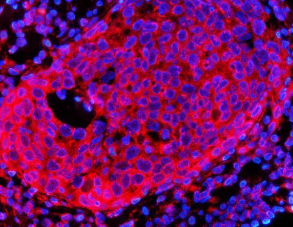 a00643 3 hmgcr primary antibodies if testing 5