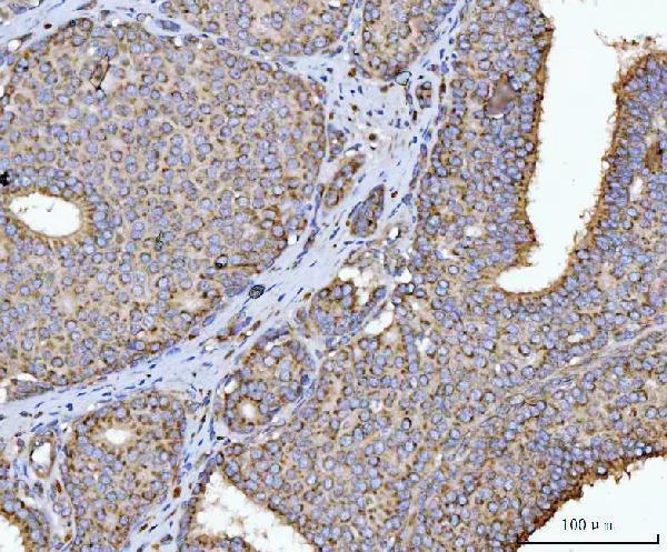  IHC analysis of HMGCR using anti-HMGCR antibody (A00643-3)