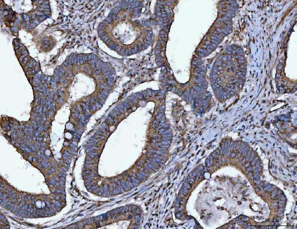  IHC analysis of HMGCR using anti-HMGCR antibody (A00643-3)