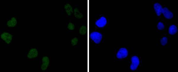 ICC staining DNA PKcs in Hela cells (green)