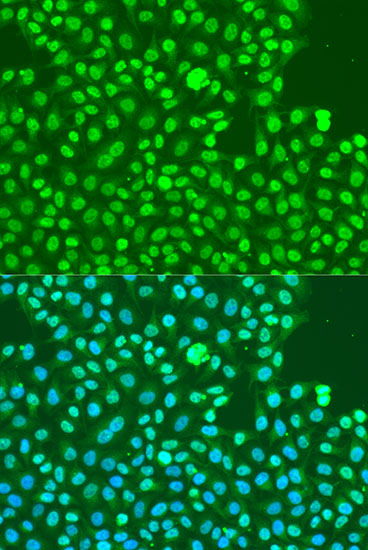 Immunofluorescence analysis of U2OS cells using Phospho-DNA-PKcs-S2056 antibody  at dilution of 1:100