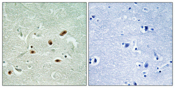 Immunohistochemical analysis of paraffin-embedded Human brain