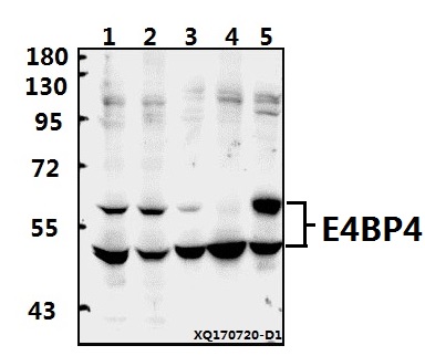 Western blot (WB) analysis of E4BP4 (E65) pAb at 1:500 dilution
Lane1:A549 whole cell lysate(40ug)
Lane2:SKOVCAR3 whole cell lysate(40ug)
Lane3:A2780 whole cell lysate(40ug)
Lane4:H9C2 whole cell lysate(40ug)
Lane5:BV2 whole cell lysate(40ug)