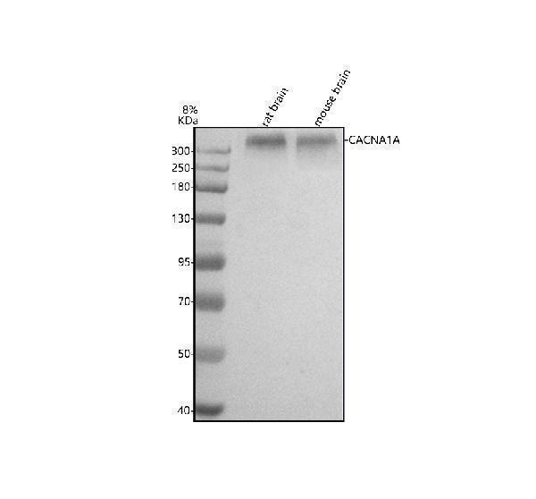  Western blot analysis of CACNA1A using anti-CACNA1A antibody (A00647)