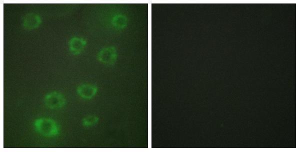 a00649 1 ptx3 primary antibodies if testing 1