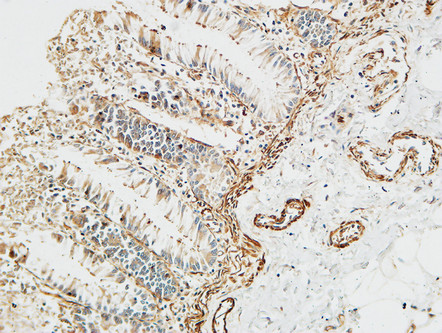 a00649 1 ptx3 primary antibodies ihc testing 6
